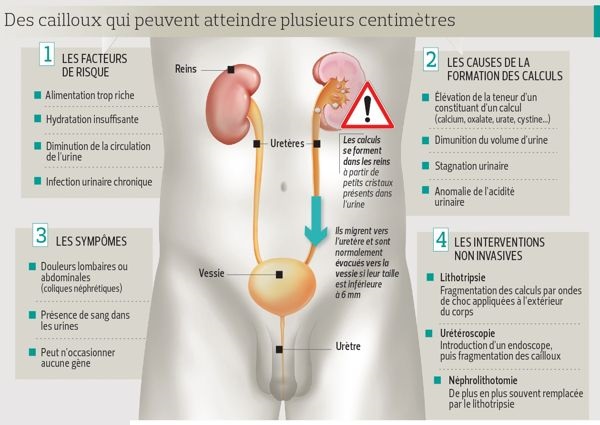 La formation des "pierres"