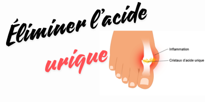 &Eacute;liminer l'acide urique