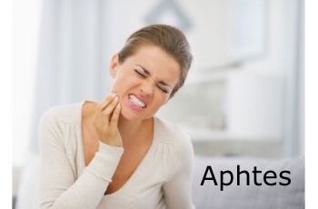 Traitements naturels des aphtes | phyto-soins