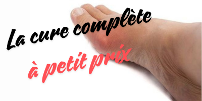 La cure compl&egrave;te contre la crise de goutte