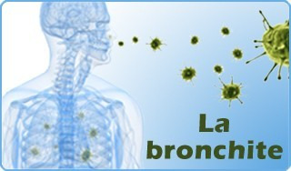Bronchite: symptômes, causes et soins naturels